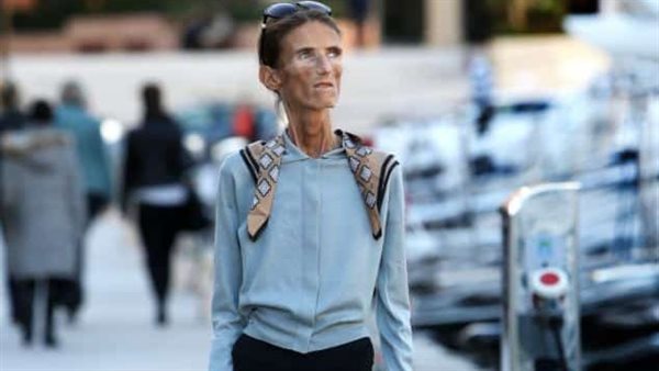 World’s Thinnest Woman Receives Fan Mail Admiring Her Figure